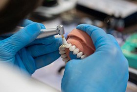 Hands of dental lab technician working on dentures